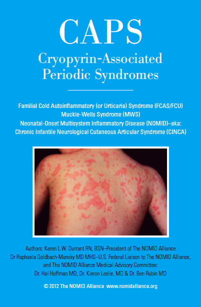 Cryopyrin Associated Periodic Syndromes CAPS Systemic