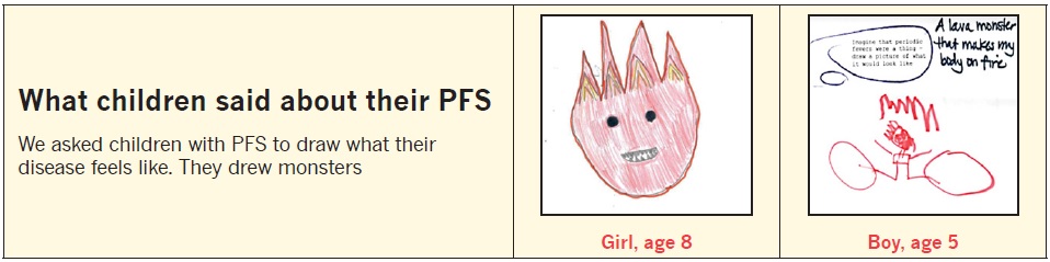 fmf-hids-traps-periodic-fever-syndromes